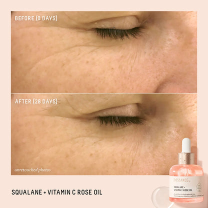 Squalane + Vitamin C Rose Oil